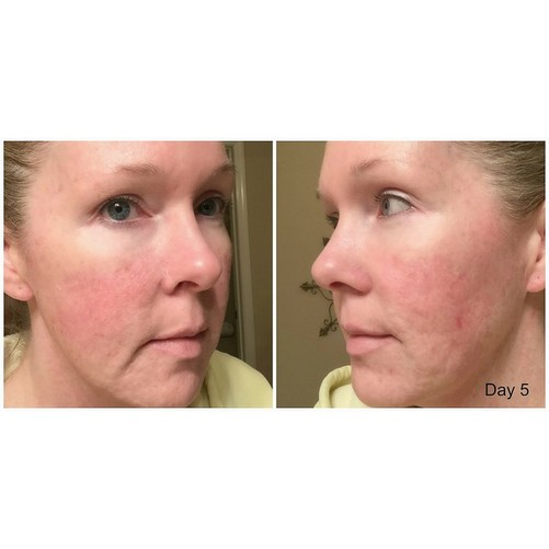 Kem Dưỡng Da Neutrogena Rapid Wrinkle Repair
