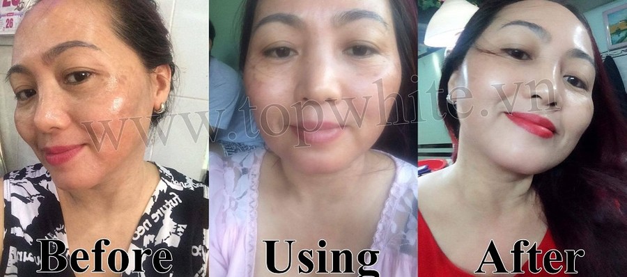 Serum Tạo Sự Căng Bong Chống Lao Hoa Da Topwhite White Perfect D6 Serum Essence Gia Chỉ 700 000đ Mua Ngay Kẻo Hết Store Salezone Vn
