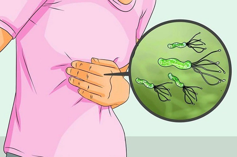 chữa đau dạ dày bằng tây y