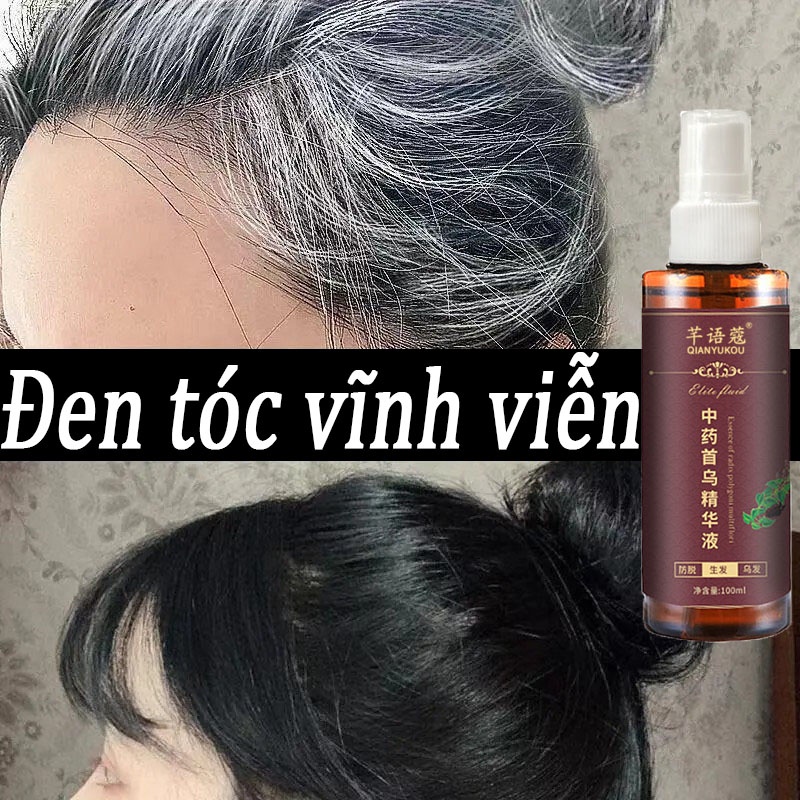 Tinh chất dầu dưỡng thảo dược xịt đen tóc vĩnh viễn phục hồi tóc bạc , giảm rụng tóc, cách chăm sóc tóc tại nhà (Mã SP: 280_101219340)