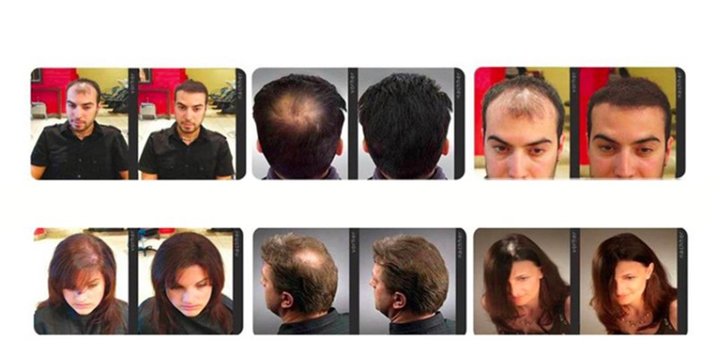 TÓC MỌC NHANH VÀ DÀY NHẬT BẢN KAMINOMOTO HAIR GROWTH ACCELERATOR 1