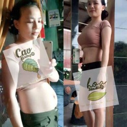 Sản Phẩm Giảm mở bụng an toàn Cao lá rừng ZN