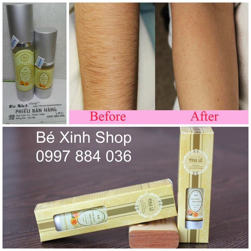 Tinh chất triệt lông vĩnh viễn 30ml 8