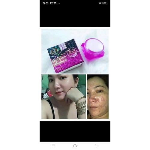 kem mụn 2c