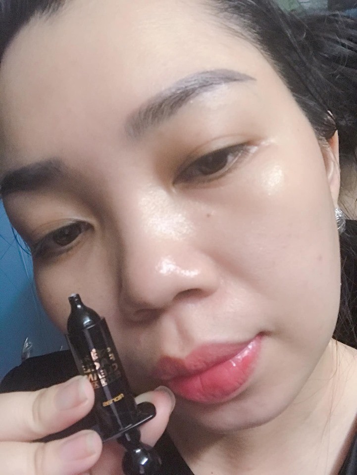 KEM VI GAI TẢO BIỂN SPICULE VÀNG 24K RONAS - DÒNG KEM VI GAI BIỂN ĐỘT PHÁ NHẤT HIỆN NAY TẠI HÀ QUỐC