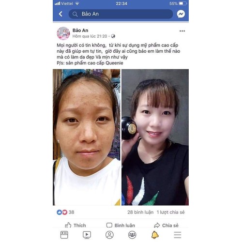 KEM FACE ĐẶT TRỊ NÁM QUEENIE SKIN