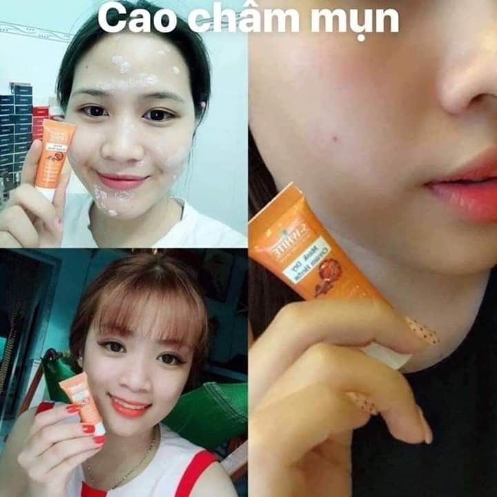 Tuýp cao khô chấm mụn SWHITE
