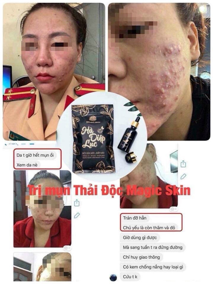 Tinh chất trị mụn Magic Skin