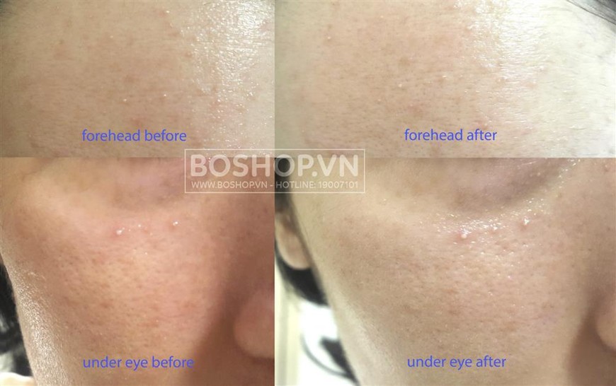 Gel đa năng đắp mặt lô hội 92