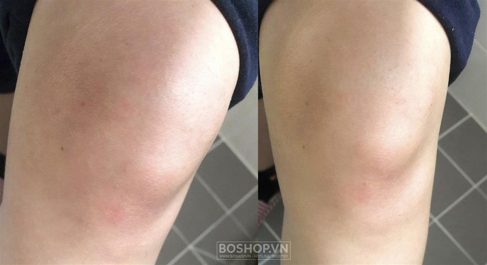 Gel đa năng đắp mặt lô hội 92