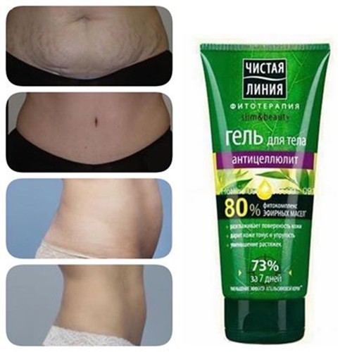 Kem Trị Rạn Da Tan Mỡ Thừa Kpem Pure Line Nga