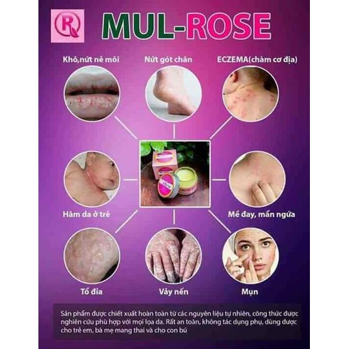 kem Mul Rose