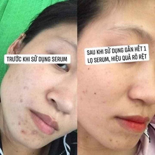 Trị Thâm SHINA SKIN