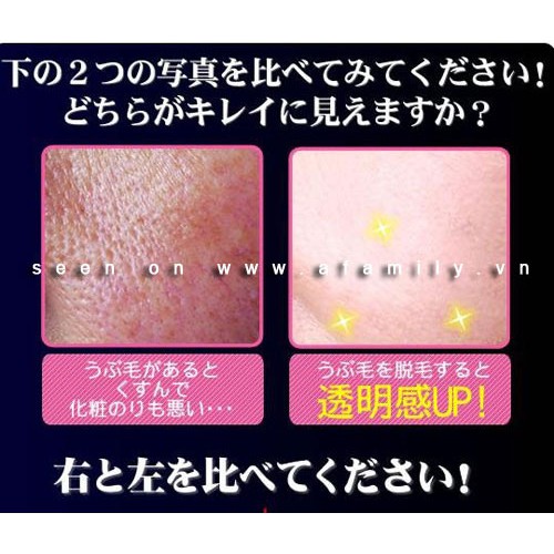 cây se lông mặt lò xo