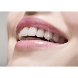 Đá Đính Răng 20 Viên Tặng Keo Bút – 1748150888