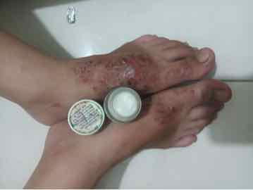 Thảo Mộc Bôi Da Trần Kim Huyền  Hàng  Công Ty