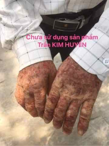 Thảo Mộc Bôi Da Trần Kim Huyền  Hàng  Công Ty