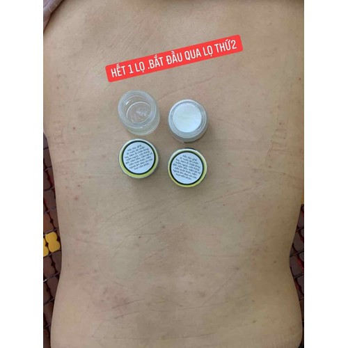 Thảo Mộc Bôi Da Trần Kim Huyền  Hàng  Công Ty