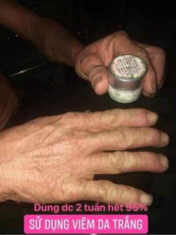 Thảo Mộc Bôi Da Trần Kim Huyền  Hàng  Công Ty