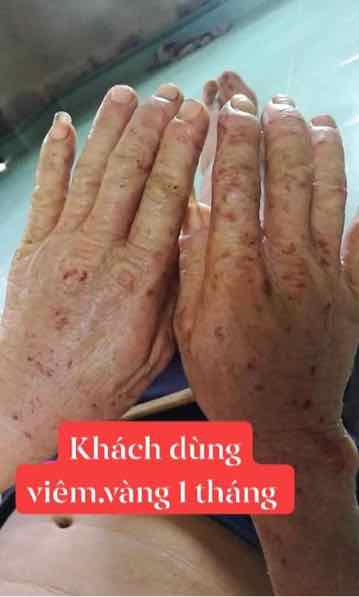 Thảo Mộc Bôi Da Trần Kim Huyền  Hàng  Công Ty