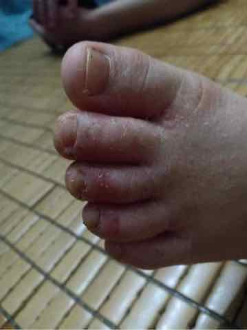 Thảo Mộc Bôi Da Trần Kim Huyền  Hàng  Công Ty