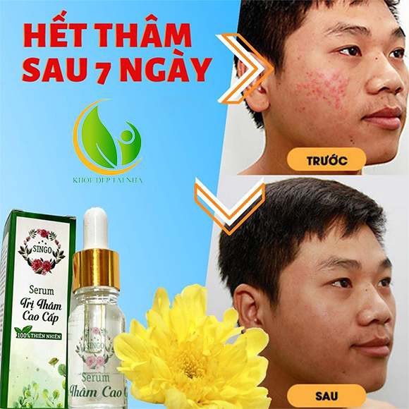 Serum trị thâm singo chính hãng