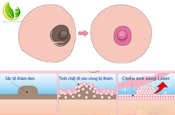 Serum trị thâm singo chính hãng