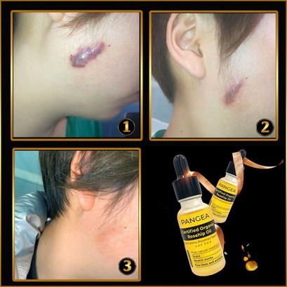 Serum PANGEA - Xóa Sẹo Chuyên Sâu 20ml