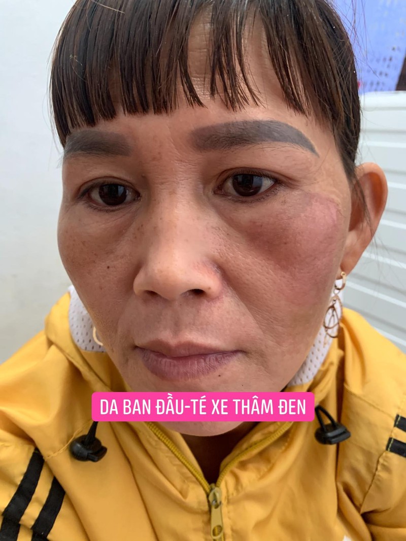 Kem tái tạo da chamomileskill mẫu mới - ttcmlm