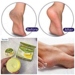 COMBO 3 HỘP KEM NỨT GÓT CHUỐI. HÀNG CHÍNH HÃNG THÁI LAN