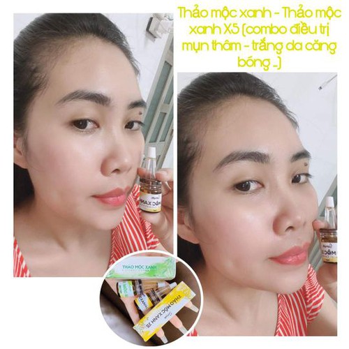 Serum căng bóng Thảo Mộc Xanh x5