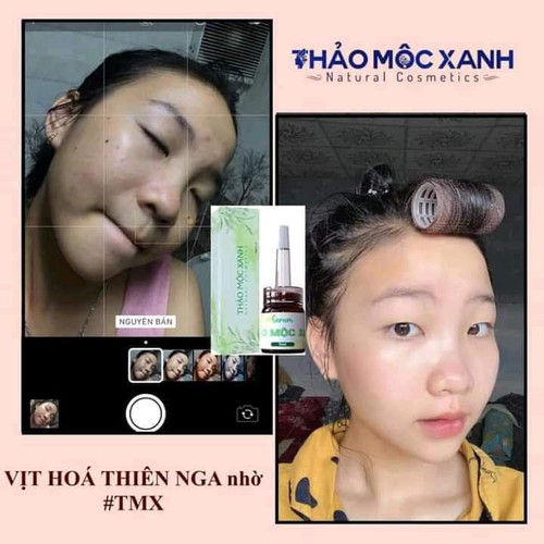 Thảo Mộc Xanh Combo
