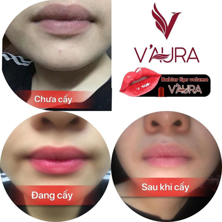 Serum VAURA 10ml cấy màu môi, khử thâm môi, giúp môi hồng tự nhiên