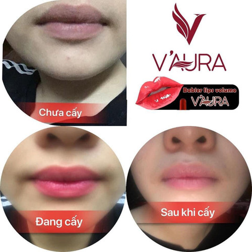 Serum VAURA 10ml cấy màu môi, khử thâm môi, giúp môi hồng tự nhiên