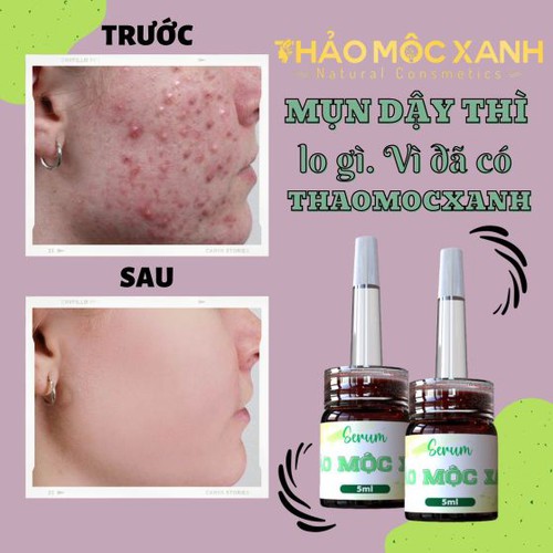 thảo mộc xanh 100% từ thiên nhiên