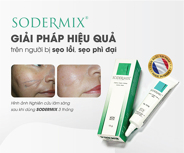 Sodermix - Giải pháp an toàn cho người bị viêm da cơ địa, chàm sữa, sẹo lồi - Kem bôi da tuýp 15g