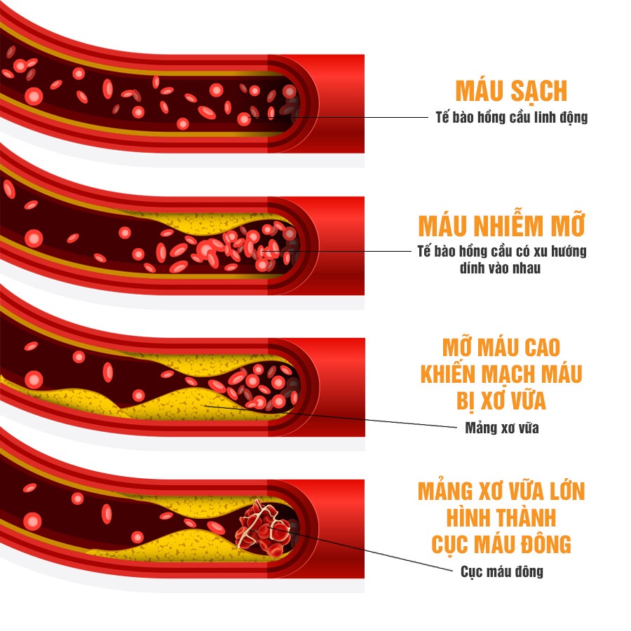 Tinh dầu thông đỏ Samsung Pine Mega Max 500mg x 120 viên