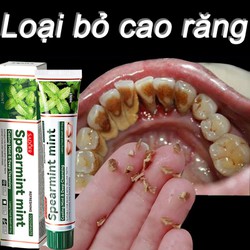 Kem Đánh Răng Làm Trắng Răng Loại Bỏ Cao Răng Hôi Miệng Tẩy Ố Vàng Không Chứa Florua SADOER 100g