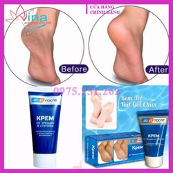 Chính hãng Chính hãng Kem nứt gót chân Kpem 50ML - NGA