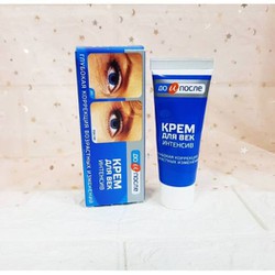 Kem xóa nếp nhăn chân chim, giảm thâm quầng mắt Kpem Eye Cream INTENSIVE